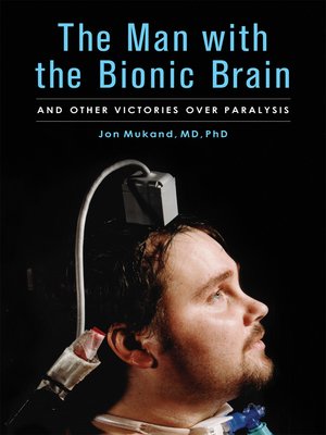 cover image of The Man with the Bionic Brain